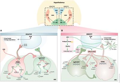 Deep Brain Stimulation for Obesity: A Review and Future Directions